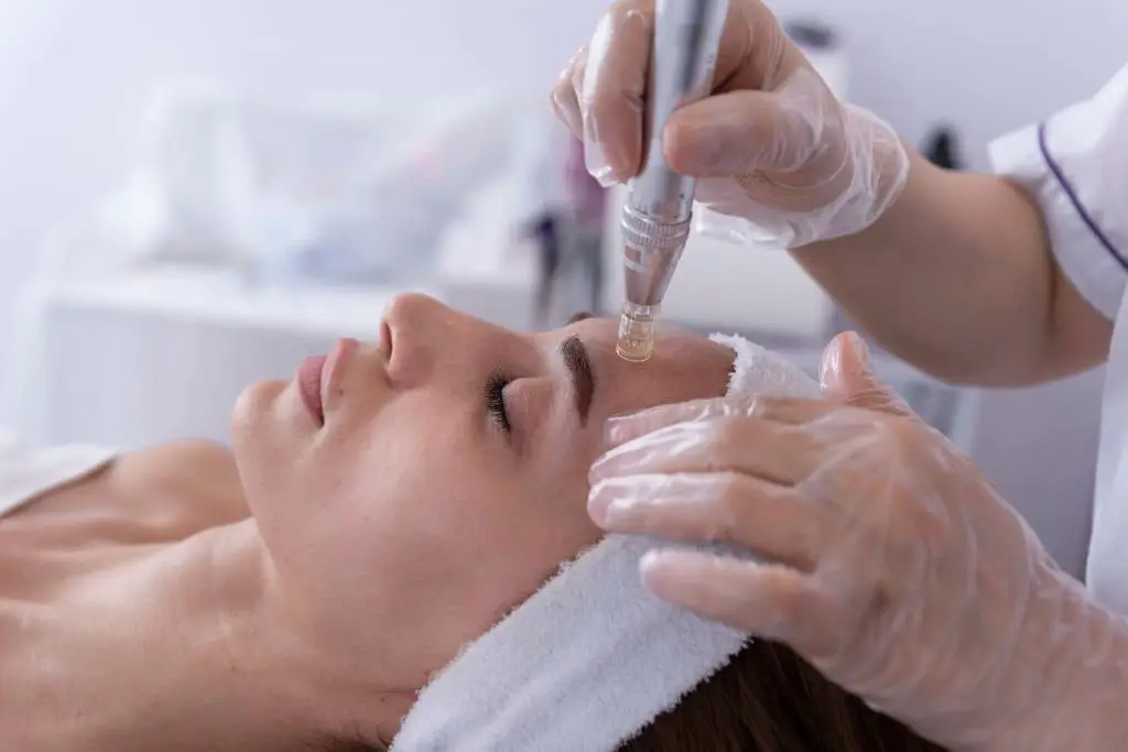 BENEFITS-OF-MICRONEEDLING-WHY-IT-IS-GOOD-FOR-YOUR-SKIN