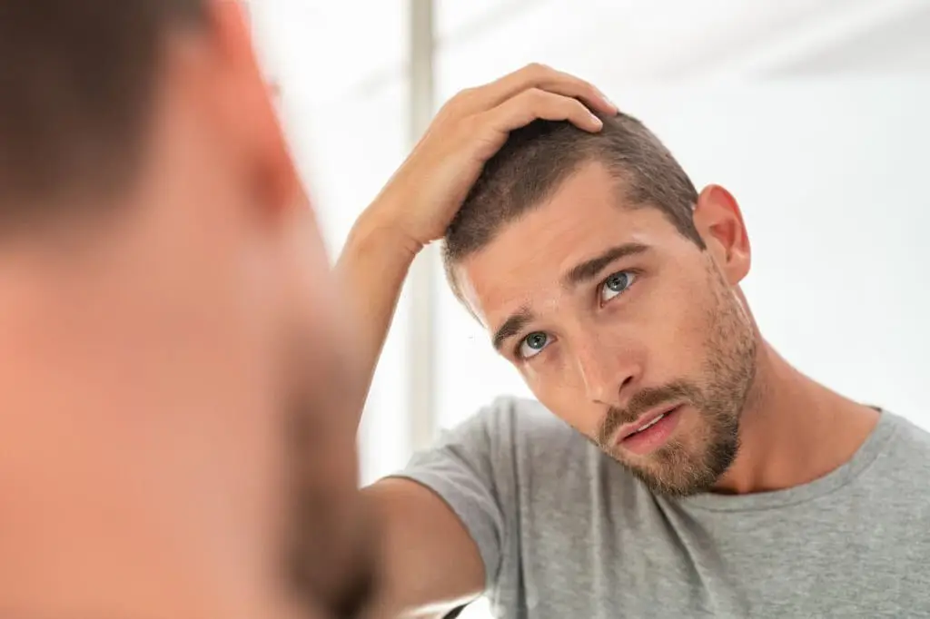 Is PRP Therapy Suitable for Men with Thinning Hair image