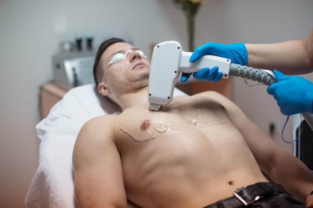 Diode Laser Hair Removal For Men: What You Need To Know
