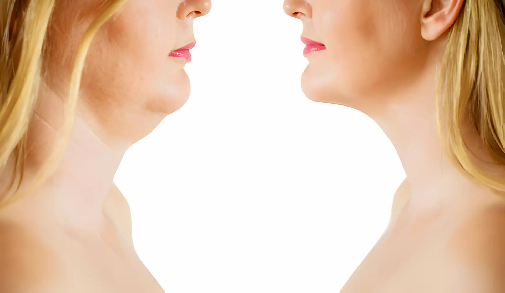 UNDERSTANDING FACIAL FAT DISSOLVE A COMPREHENSIVE GUIDE