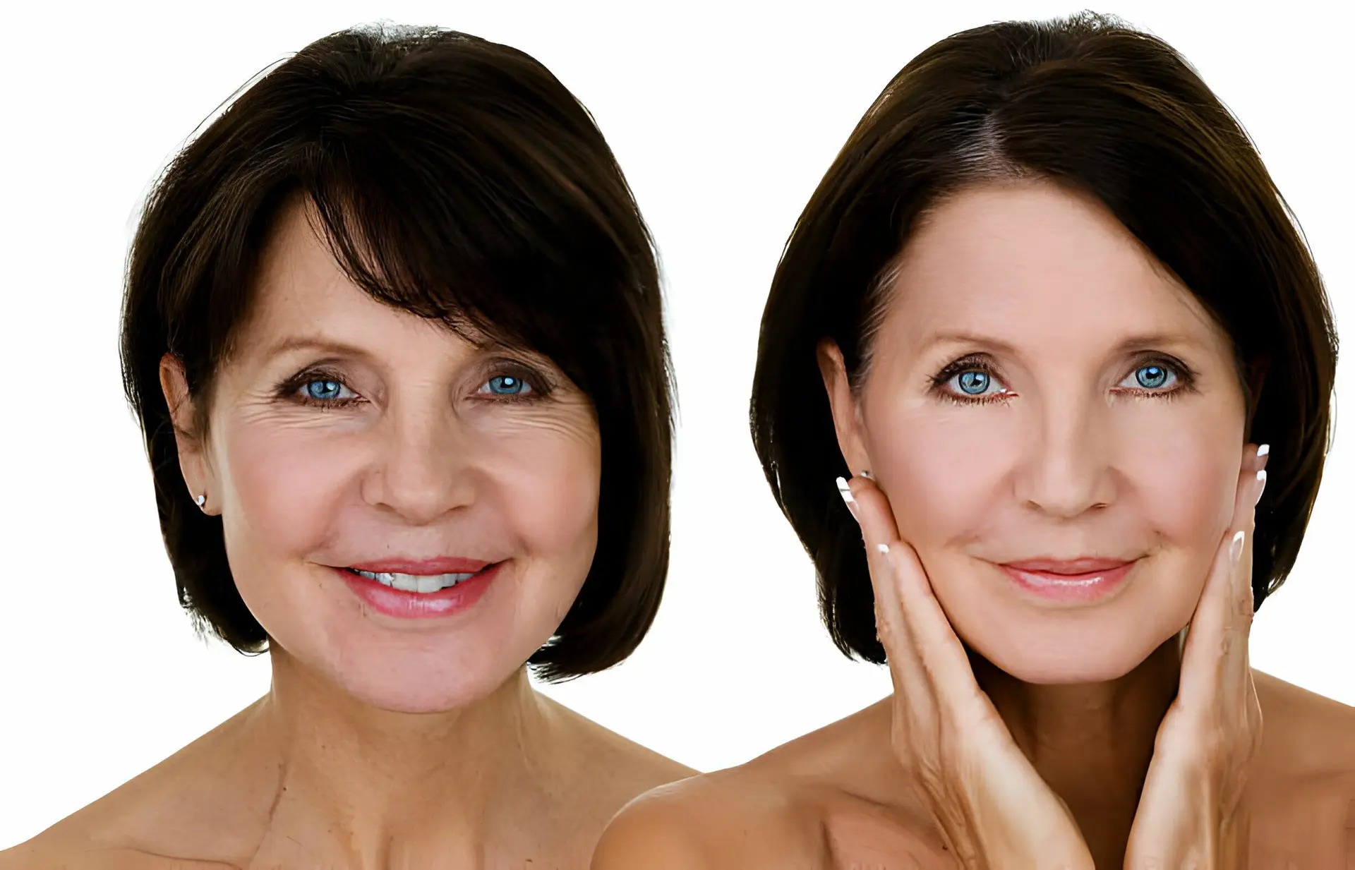 BOTOX AND AGING MANAGING EXPECTATIONS FOR LONG-TERM RESULTS new