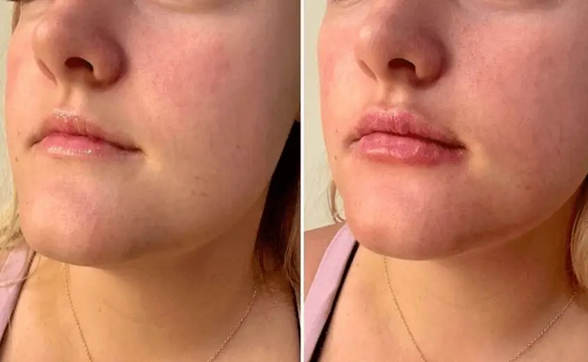 R & R Aesthetics-instagram-image-post-roswell-ga