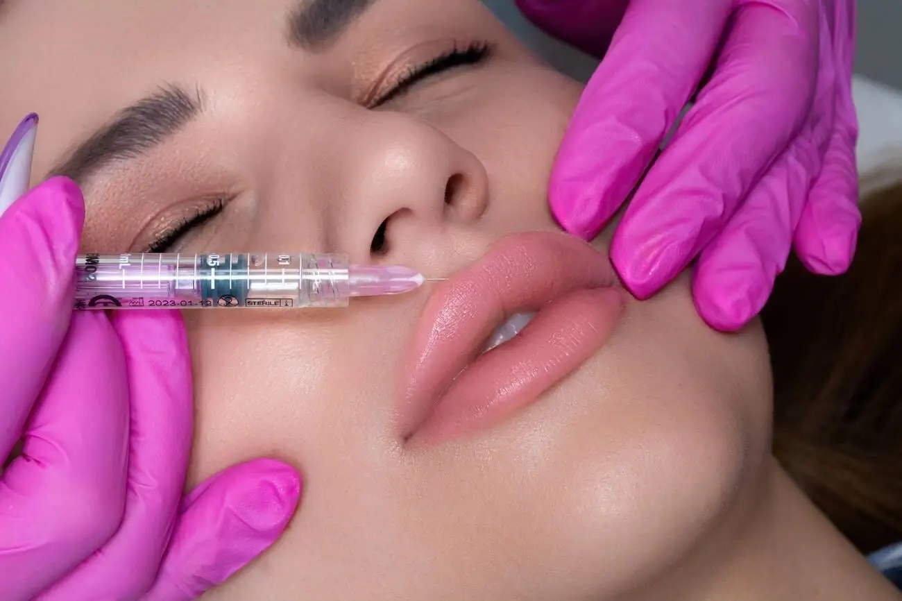 A woman with naturally enhanced, voluminous lips highlighting the latest lip filler trends and techniques for a perfect pout.