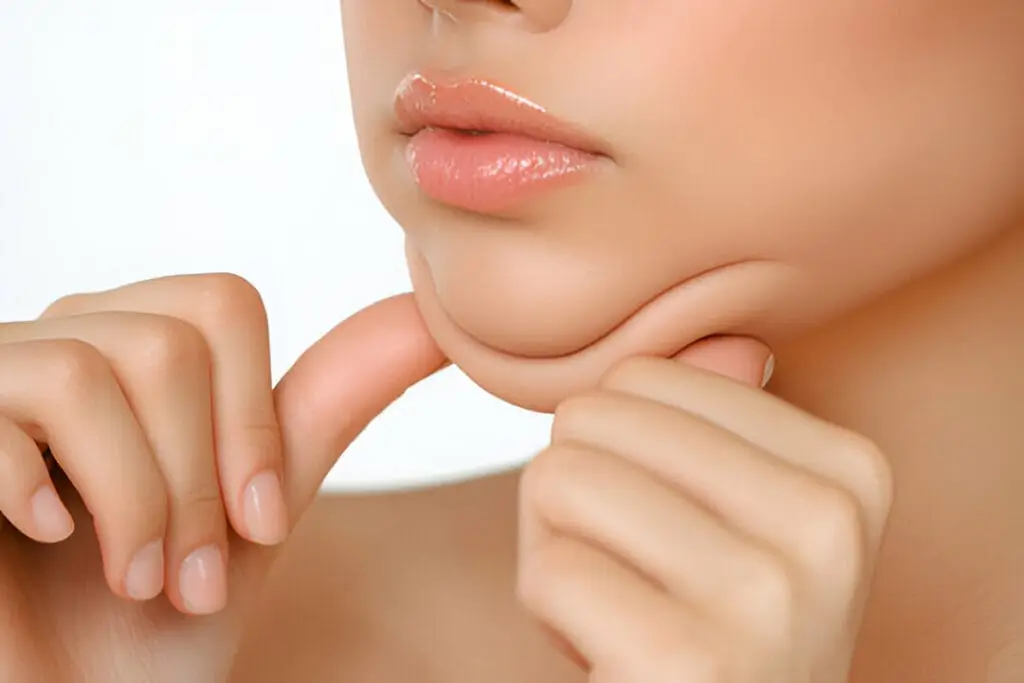 Side profile of a woman with a defined jawline, illustrating the body contouring results of facial fat-dissolving treatments.
