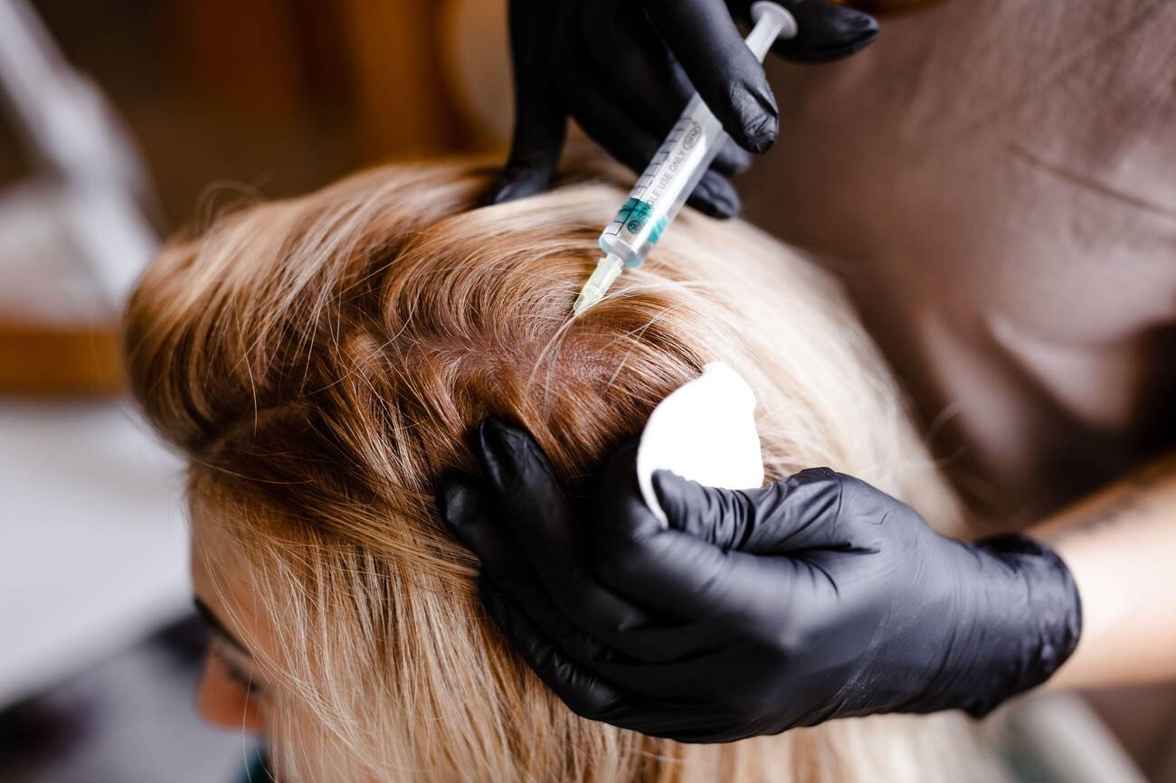 PRP-for-Hair-Restoration-What-to-Expect-&-How-Many-Sessions