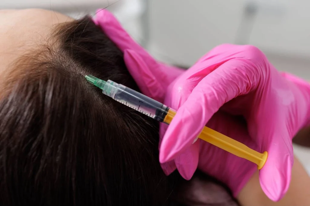 PRP-for-Hair-Restoration-What-to-Expect-and-How-Many-Sessions